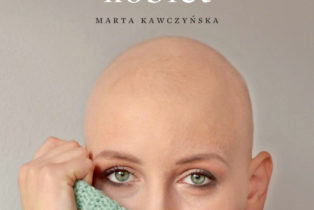 Alopecjanki