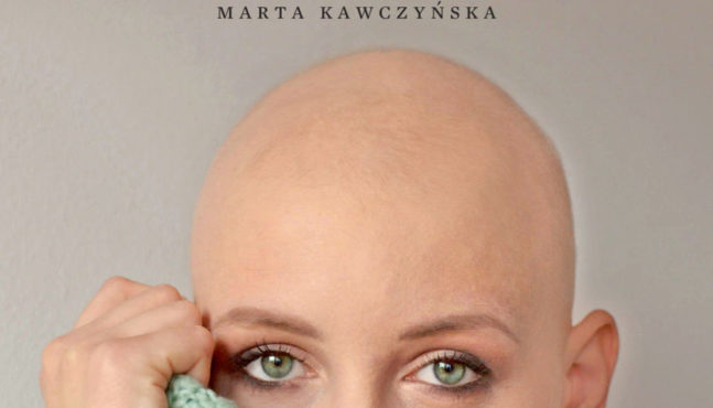 Alopecjanki